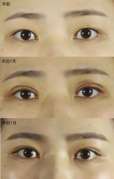 图片11.png 图片11.png