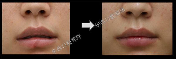 图片 139.jpg 图片 139.jpg