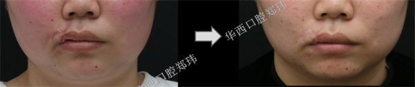 图片 140.jpg 图片 140.jpg