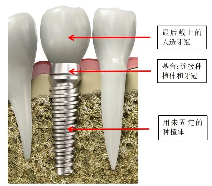 图片 167 图片 167